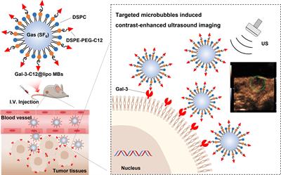 Contrast-enhanced ultrasound combined targeted microbubbles for diagnosis of highly aggressive papillary thyroid carcinoma